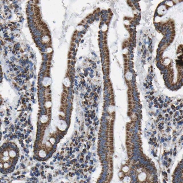 Anti-IRX6 antibody produced in rabbit