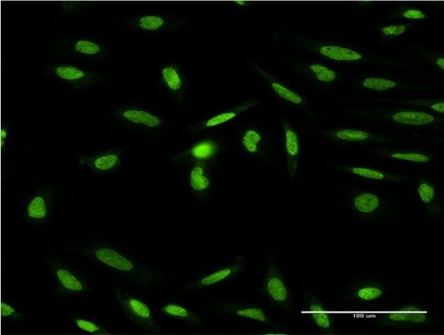 ANTI-ISL1 antibody produced in mouse