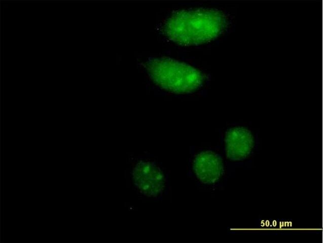 Anti-ISL2 antibody produced in mouse