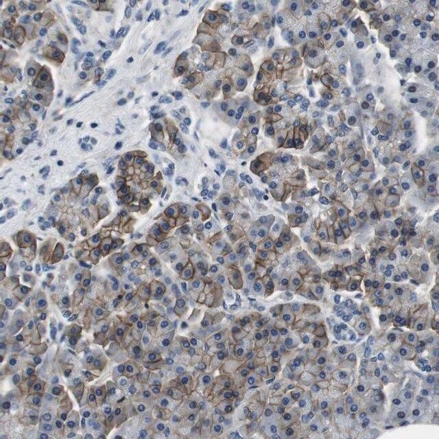 Anti-KCNJ5 antibody produced in rabbit