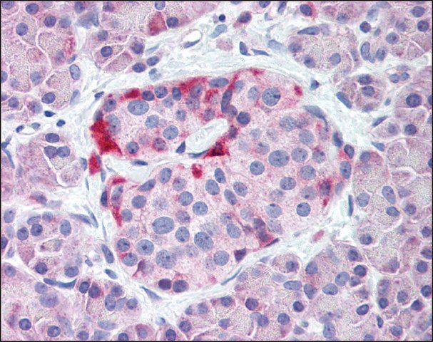 Anti-KCNJ6 / GIRK2 antibody produced in rabbit