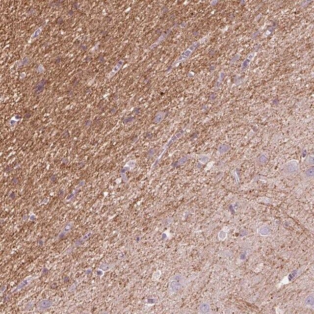 Anti-KCNIP3 antibody produced in rabbit