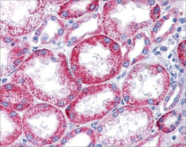 Anti-KCNQ1
