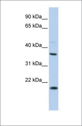 Anti-KCNMB3 antibody produced in rabbit