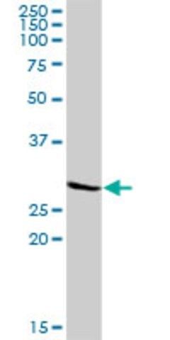 Anti-KCNIP3 antibody produced in rabbit