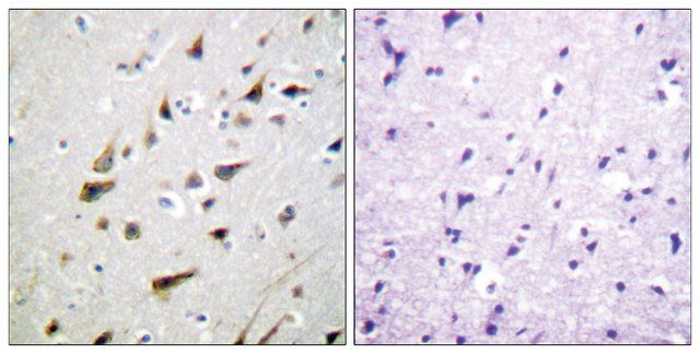 Anti-KCNIP3 antibody produced in rabbit