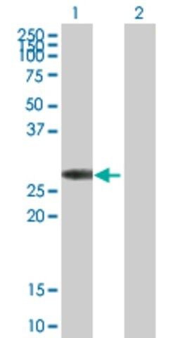 Anti-KCNIP3 antibody produced in mouse