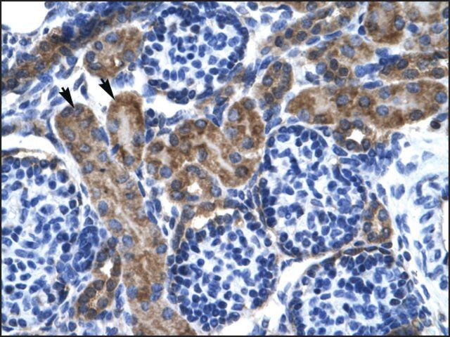 Anti-KCNQ2 antibody produced in rabbit