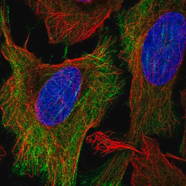 Anti-KCNN1 antibody produced in rabbit