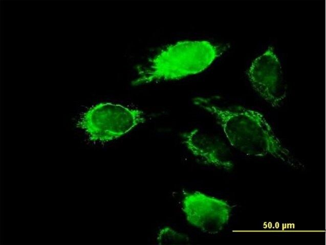 Anti-KCNIP2 antibody produced in mouse