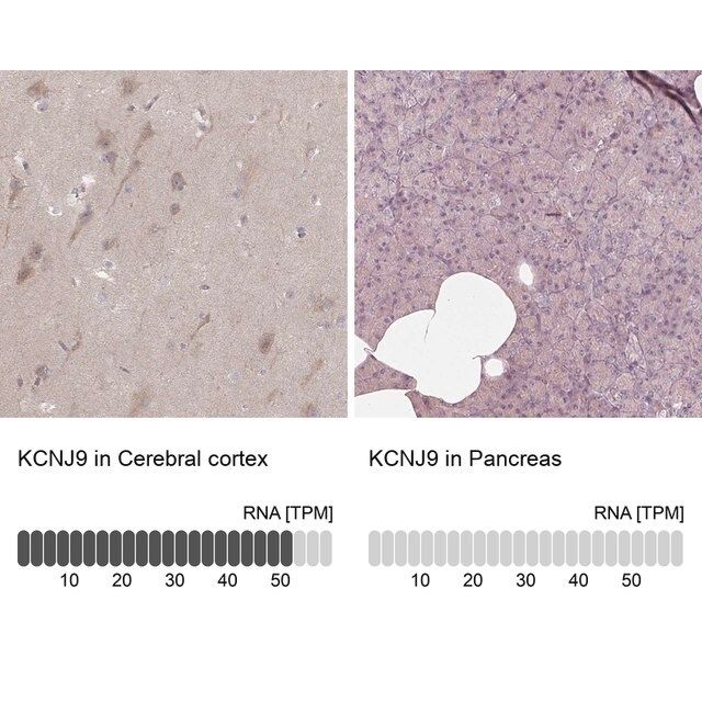 Anti-KCNJ9 antibody produced in rabbit