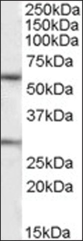 Anti-KCNQ1 (C-terminal) antibody produced in goat