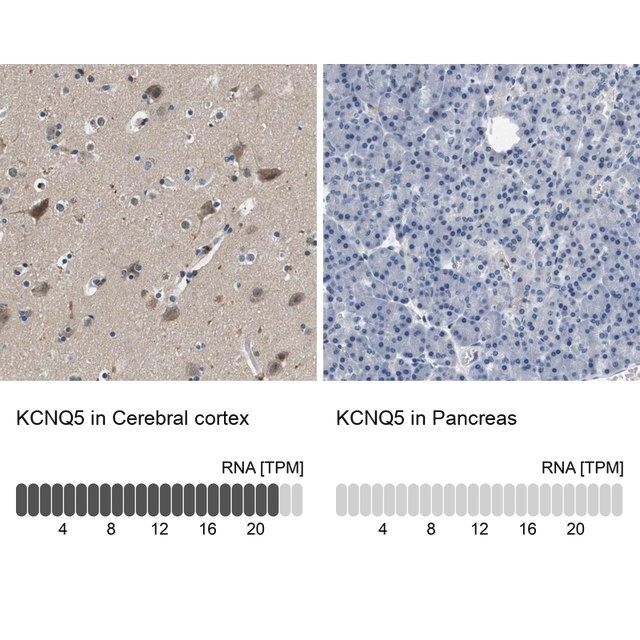 Anti-KCNQ5 antibody produced in rabbit