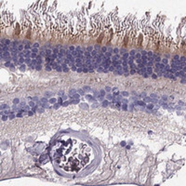 Anti-KCNV2 antibody produced in rabbit