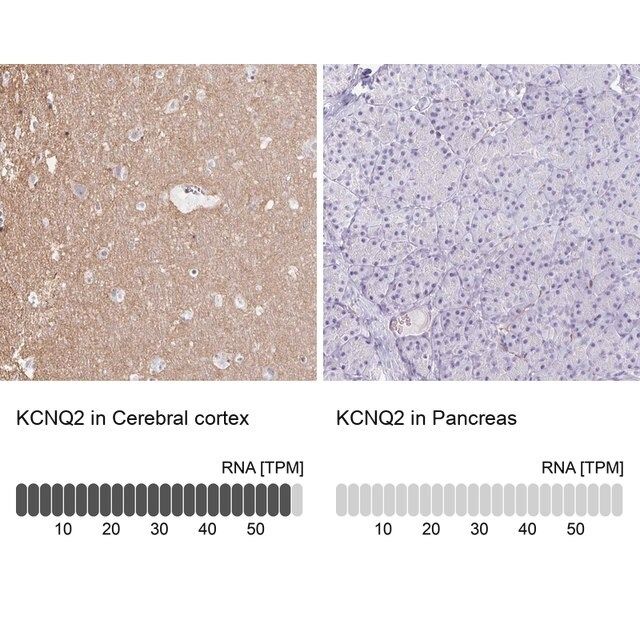 Anti-KCNQ2 antibody produced in rabbit
