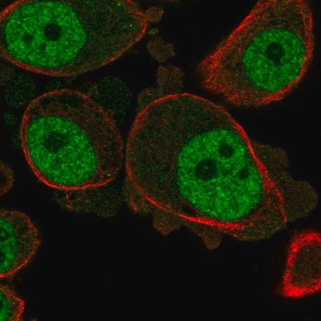 Anti-KCNN3 antibody produced in rabbit