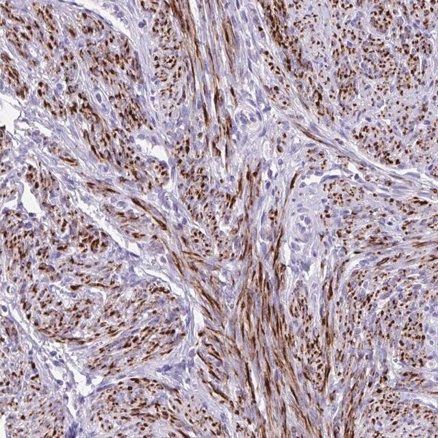 Anti-KCNN4 antibody produced in rabbit