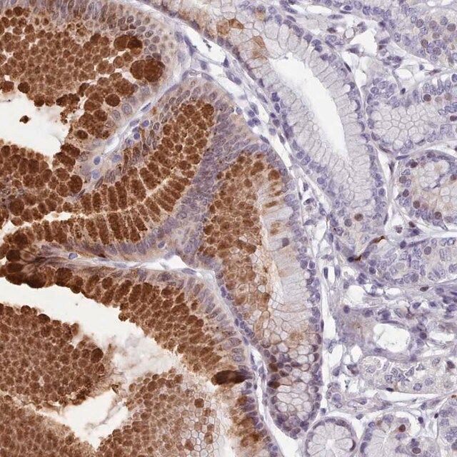 Anti-KCNT2 antibody produced in rabbit