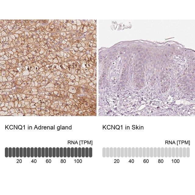 Anti-KCNQ1 antibody produced in rabbit