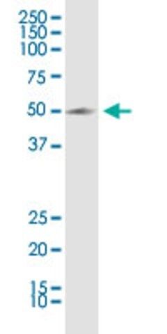 Anti-KCNN4 antibody produced in rabbit