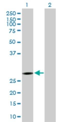 Anti-KCTD6 antibody produced in mouse
