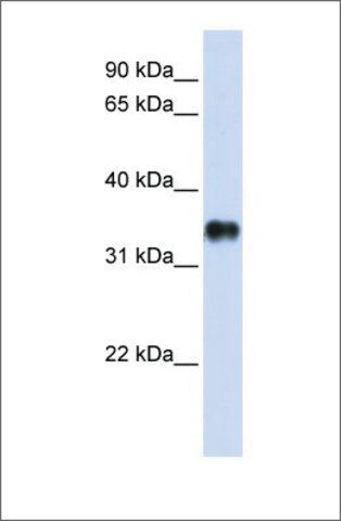 Anti-KCTD7 antibody produced in rabbit