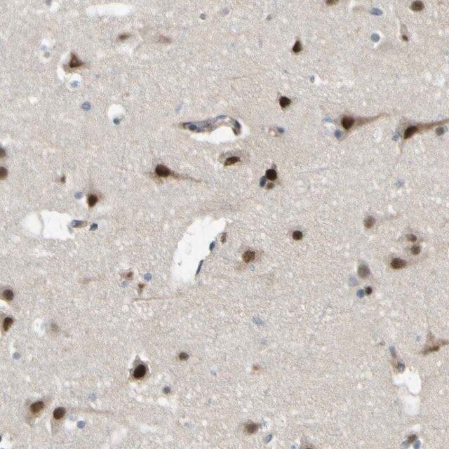 Anti-KDM7A antibody produced in rabbit