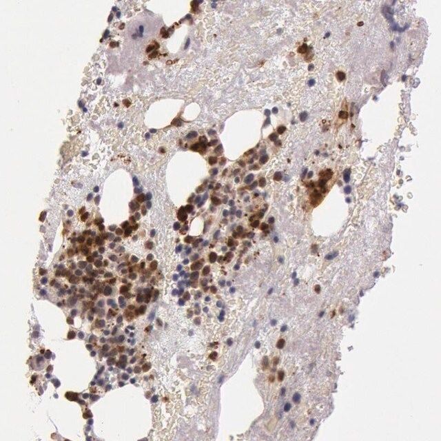 ANTI-KDM6A antibody produced in rabbit
