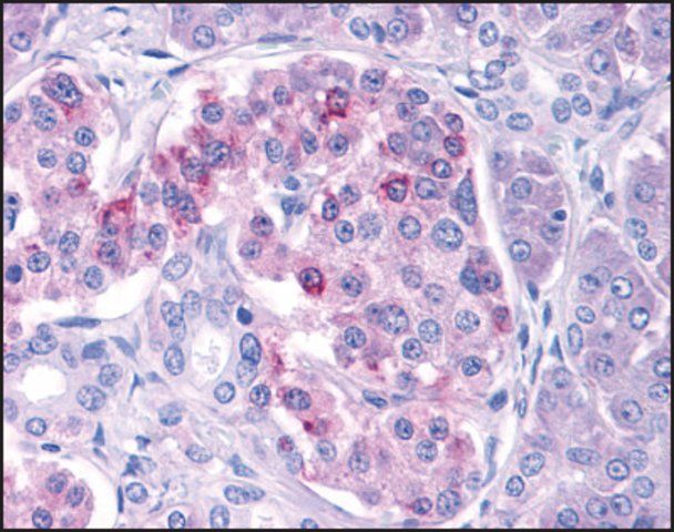 Anti-IKKε antibody produced in rabbit