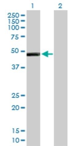 Anti-IL13RA2 antibody produced in mouse