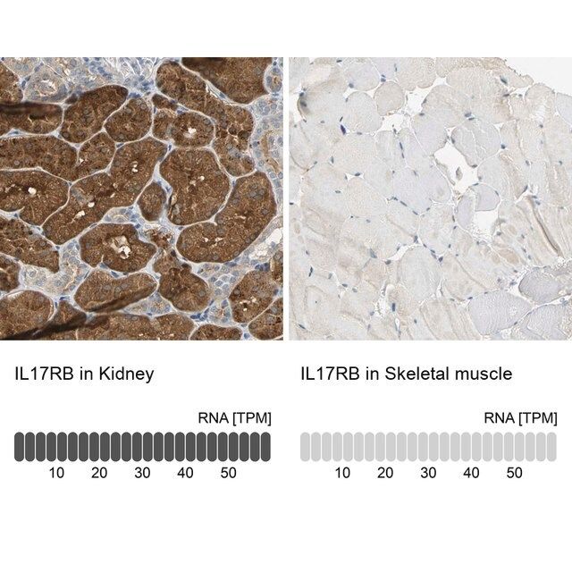 Anti-IL17RB antibody produced in rabbit