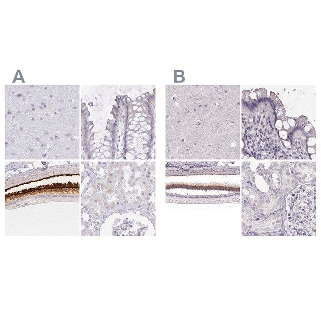 Anti-IMPG1 antibody produced in rabbit