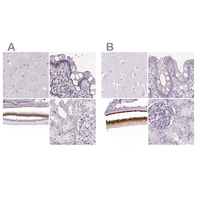 Anti-IMPG1 antibody produced in rabbit