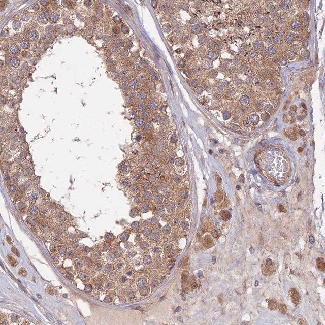 Anti-INCA1 antibody produced in rabbit