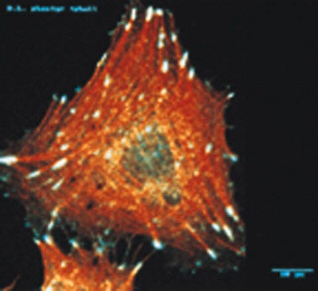 Anti-Integrin αV Antibody, clone LM142