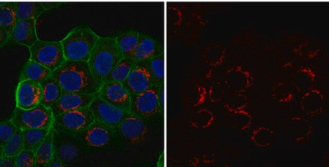 Anti-Integrin β1 Antibody, activated, clone HUTS-4, Alexa Fluor<sup>®</sup> 555