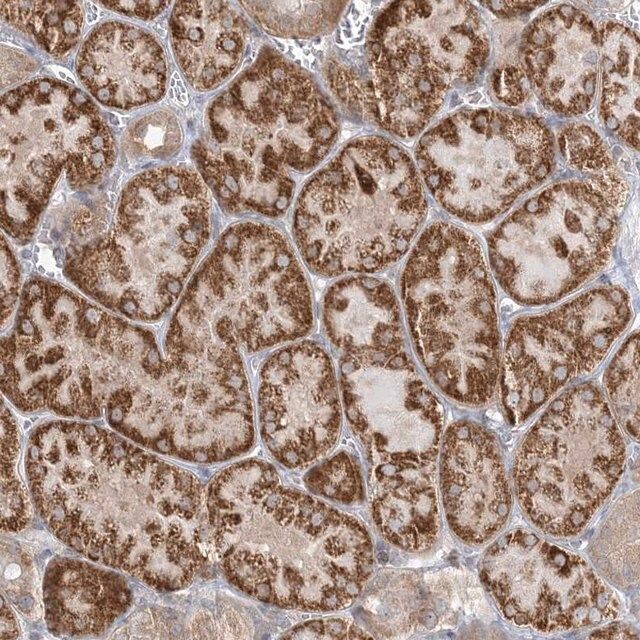 Anti-INPP1 antibody produced in rabbit