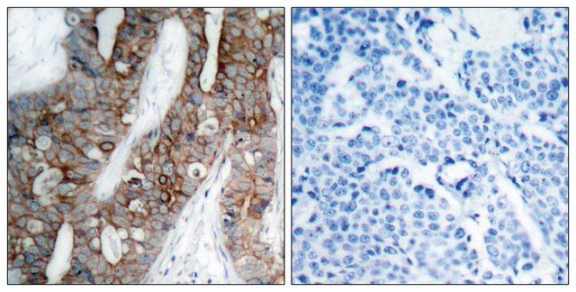 Anti-Integrin β3 antibody produced in rabbit