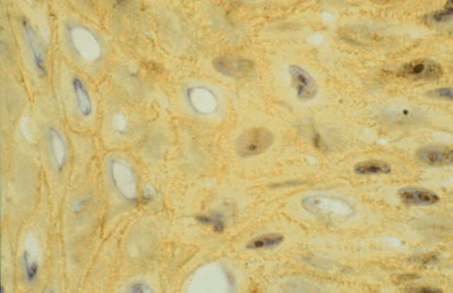 Anti-Integrin αV Antibody, clone 13C2
