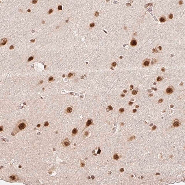 Anti-INTS8 antibody produced in rabbit