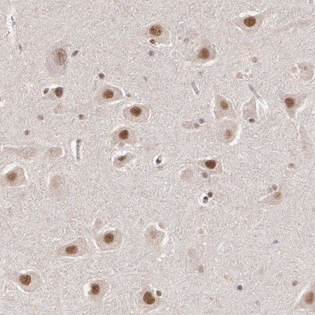 Anti-INTS6 antibody produced in rabbit