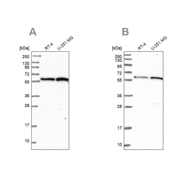 Anti-INTS14 antibody produced in rabbit