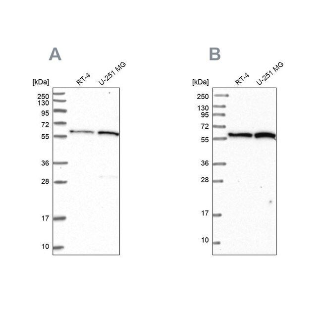 Anti-INTS14 antibody produced in rabbit