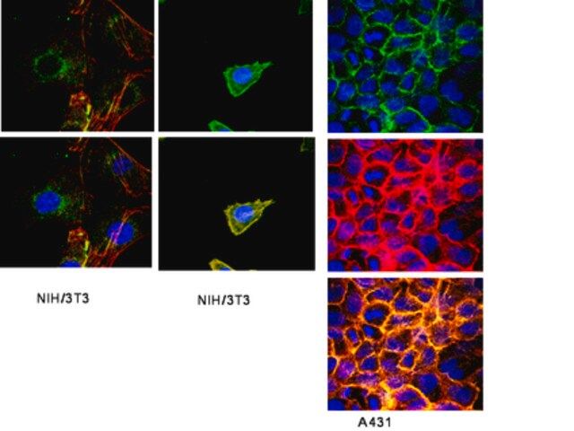 Anti-Integrin beta1 Antibody, clone HM beta 1.1