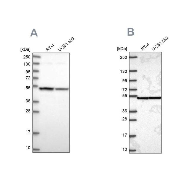 Anti-IPO4 antibody produced in rabbit