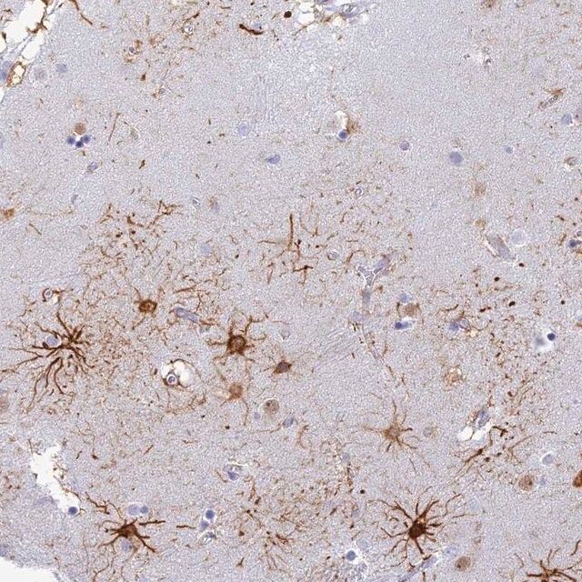 Anti-INTS13 antibody produced in rabbit