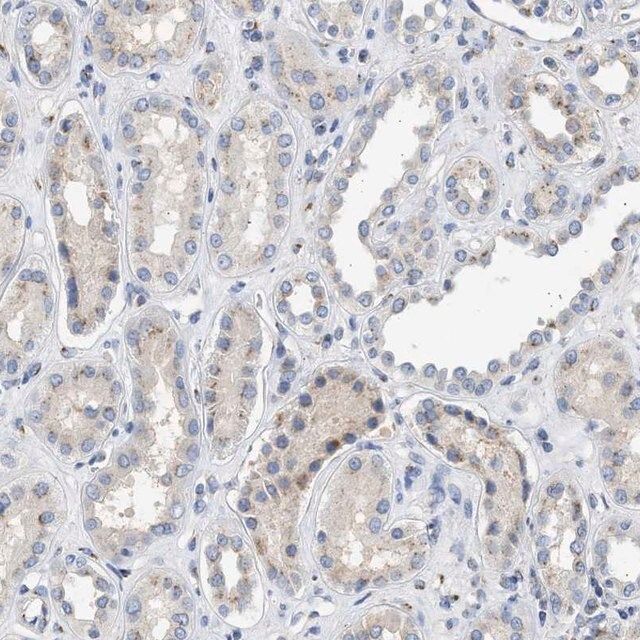 Anti-IPO8 antibody produced in rabbit