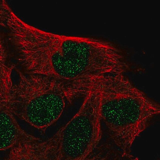 Anti-IQCD antibody produced in rabbit