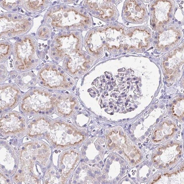 Anti-IGSF5 antibody produced in rabbit