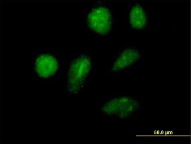 Anti-IKZF2 antibody produced in mouse